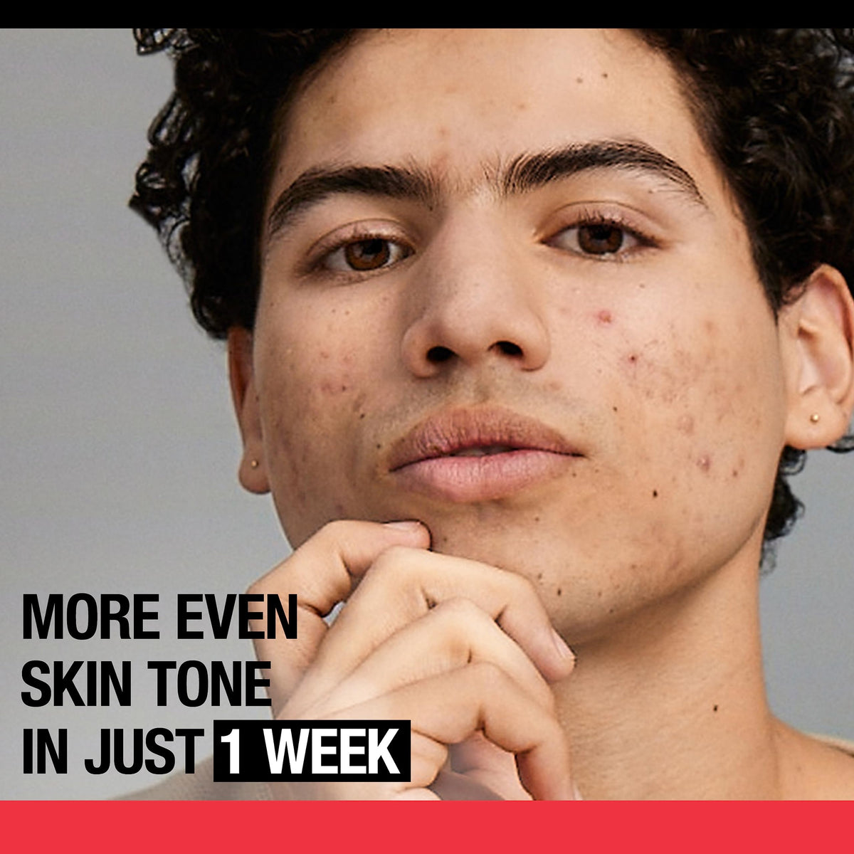 Stubborn Marks Pm Treatment With Retinol Sa, Face-Exfoliating Treatment, Oil-Free, Non-Comedogenic, Unscent V468062